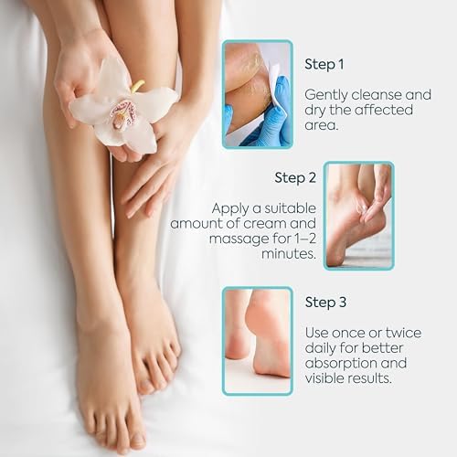 CLASYCARE Topuk Çatlağı Kremi – Kuru ve Çatlamış Topuklar için – E Vitamini ve Avokado Yağlı Topuk Kremi – Nasır, Sert ve Ölü Deriler için Nemlendirici Ayak Bakım Kremi – 100 ml