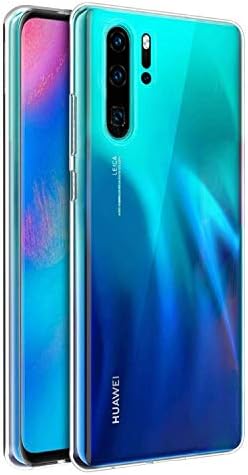 41ronMqu7LL._AC_SL1500_