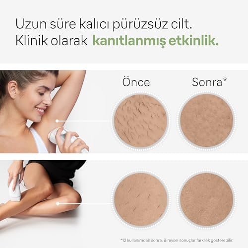 Silk Expert Pro 3 PL3133 300.000 Atımlı, 2 Başlıklı Yeni Nesil IPL + Seyahat Çantası, Beyaz