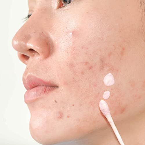 Akne Karşıtı Losyon 30 ML