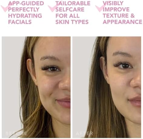 UFO Mini 2 Power Maske ve Işık Terapi Cihazı